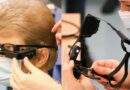 Mujer recupera la vista parcialmente gracias a un ‘chip’ en su ojo